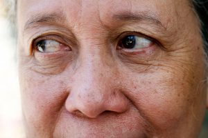 Η κατάθλιψη στους ασθενείς μετά την καρδιακή προσβολή συχνά αγνοείται